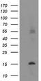 Transmembrane Protein 230 antibody, TA504942, Origene, Western Blot image 