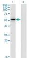 Proteasome 26S Subunit, Non-ATPase 4 antibody, H00005710-M01, Novus Biologicals, Western Blot image 