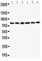 LIM Domain Containing Preferred Translocation Partner In Lipoma antibody, PA2040, Boster Biological Technology, Western Blot image 