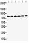 Lipoma-preferred partner antibody, PA2040, Boster Biological Technology, Western Blot image 