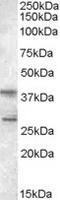 Src Kinase Associated Phosphoprotein 2 antibody, TA302599, Origene, Western Blot image 