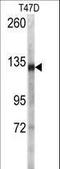 Desmoglein 2 antibody, LS-C96733, Lifespan Biosciences, Western Blot image 