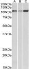 ATPase Sarcoplasmic/Endoplasmic Reticulum Ca2+ Transporting 2 antibody, MBS423368, MyBioSource, Western Blot image 
