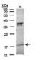 Interferon Alpha 6 antibody, PA5-21942, Invitrogen Antibodies, Western Blot image 