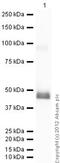 Serpin Family H Member 1 antibody, ab77609, Abcam, Western Blot image 
