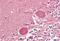 Sonic hedgehog protein antibody, MBS249217, MyBioSource, Immunohistochemistry paraffin image 