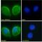 GLI2 antibody, 45-674, ProSci, Enzyme Linked Immunosorbent Assay image 