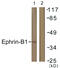 Ephrin B1 antibody, GTX87196, GeneTex, Western Blot image 