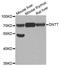 DNA Nucleotidylexotransferase antibody, A6254, ABclonal Technology, Western Blot image 