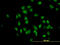 TUB Like Protein 2 antibody, LS-C198385, Lifespan Biosciences, Immunofluorescence image 