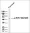 Activating Transcription Factor 2 antibody, orb4589, Biorbyt, Western Blot image 