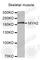 MyHC-IIa antibody, A3620, ABclonal Technology, Western Blot image 