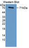 Proteasome 26S Subunit, Non-ATPase 4 antibody, LS-C713563, Lifespan Biosciences, Western Blot image 