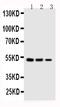 KST antibody, PA1638, Boster Biological Technology, Western Blot image 
