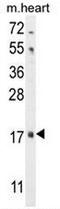 Fibroblast Growth Factor 16 antibody, AP51654PU-N, Origene, Western Blot image 
