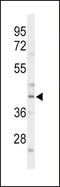 CCAAT Enhancer Binding Protein Alpha antibody, 63-967, ProSci, Western Blot image 