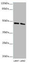 STAM Binding Protein antibody, A55623-100, Epigentek, Western Blot image 