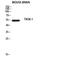 Potassium Two Pore Domain Channel Subfamily K Member 3 antibody, STJ97642, St John