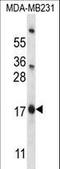 Pleckstrin Homology Like Domain Family A Member 2 antibody, LS-C163577, Lifespan Biosciences, Western Blot image 