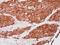 Heat Shock Protein Family B (Small) Member 1 antibody, GTX101145, GeneTex, Immunohistochemistry paraffin image 