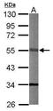 Serine/Threonine Kinase 40 antibody, GTX111412, GeneTex, Western Blot image 