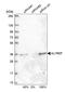 Aly/REF Export Factor antibody, HPA019799, Atlas Antibodies, Western Blot image 