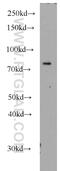 Polo Like Kinase 2 antibody, 15956-1-AP, Proteintech Group, Western Blot image 