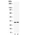 Insulin Like Growth Factor Binding Protein 1 antibody, R32108, NSJ Bioreagents, Western Blot image 