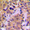Cholinergic Receptor Nicotinic Alpha 1 Subunit antibody, GTX56028, GeneTex, Immunohistochemistry paraffin image 