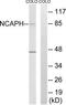 Non-SMC Condensin I Complex Subunit H antibody, TA312713, Origene, Western Blot image 