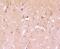 Protein Kinase C Alpha antibody, NBP2-66799, Novus Biologicals, Immunohistochemistry paraffin image 