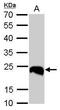 Ubiquitin C-Terminal Hydrolase L1 antibody, PA5-29012, Invitrogen Antibodies, Western Blot image 