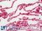 Annexin A3 antibody, LS-C316659, Lifespan Biosciences, Immunohistochemistry paraffin image 