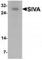 Apoptosis regulatory protein Siva antibody, TA319827, Origene, Western Blot image 