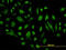 Gamma-Aminobutyric Acid Type B Receptor Subunit 1 antibody, LS-C197262, Lifespan Biosciences, Immunofluorescence image 