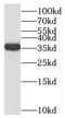 Prostate Stem Cell Antigen antibody, FNab06848, FineTest, Western Blot image 