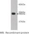 FAT Atypical Cadherin 4 antibody, MBS355193, MyBioSource, Western Blot image 