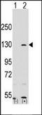 Keratin 10 antibody, orb214167, Biorbyt, Western Blot image 