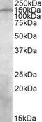 Phosphatidylinositol 3,4,5-trisphosphate-dependent Rac exchanger 1 protein antibody, GTX88346, GeneTex, Western Blot image 