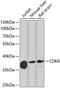 Cyclin Dependent Kinase 6 antibody, 13-257, ProSci, Western Blot image 