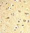 SRY-Box 4 antibody, GTX82512, GeneTex, Immunohistochemistry paraffin image 