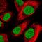 Zinc Finger Homeobox 4 antibody, PA5-54897, Invitrogen Antibodies, Immunofluorescence image 
