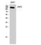 Janus Kinase 3 antibody, A02598, Boster Biological Technology, Western Blot image 