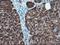 Branched Chain Amino Acid Transaminase 1 antibody, NBP2-01826, Novus Biologicals, Immunohistochemistry paraffin image 