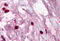 Tryptase Alpha/Beta 1 antibody, MBS245244, MyBioSource, Immunohistochemistry frozen image 
