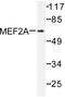 Myocyte Enhancer Factor 2A antibody, AP06219PU-N, Origene, Western Blot image 