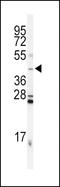 Inhibin Subunit Alpha antibody, LS-C165240, Lifespan Biosciences, Western Blot image 