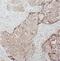 TBC1 Domain Family Member 17 antibody, FNab08510, FineTest, Immunohistochemistry paraffin image 