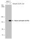 Regulatory-associated protein of mTOR antibody, GTX133196, GeneTex, Western Blot image 