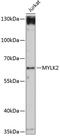 Myosin Light Chain Kinase 2 antibody, 15-472, ProSci, Western Blot image 